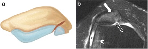 Fig. 10