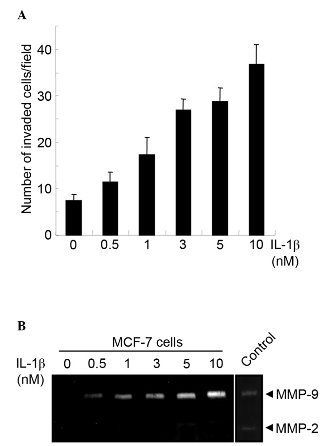 Interleukin-1β activates focal adhesion kinase and Src to induce matrix ...