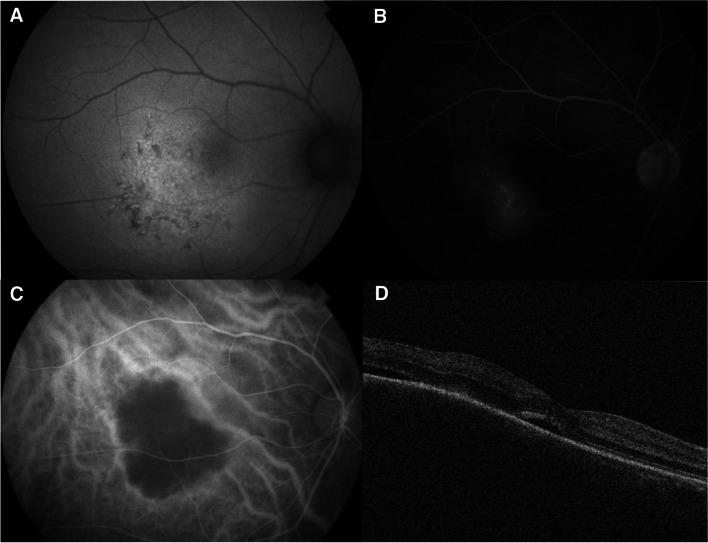 Fig. 3