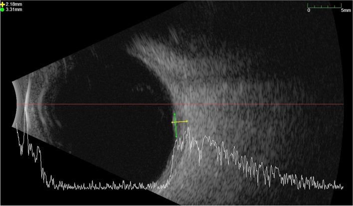 Fig. 2