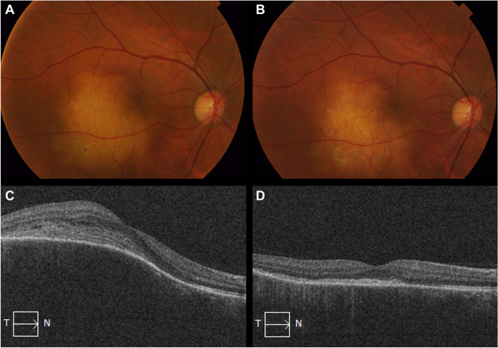 Fig. 4