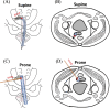 Fig. 1