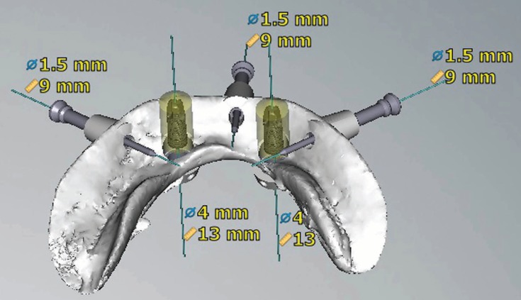 Figure 2