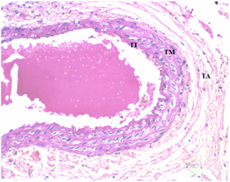 Fig. 1