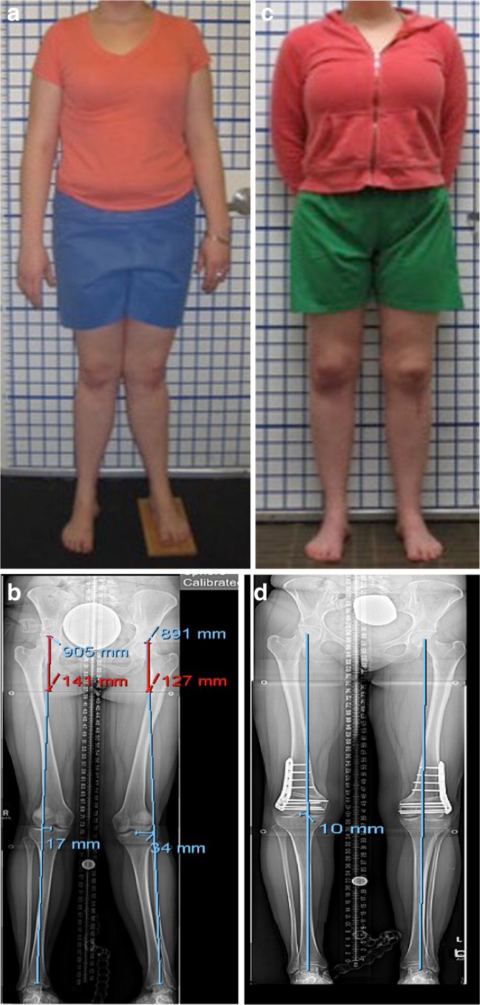 Fig. 4