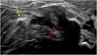 Fig. 6