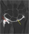 Fig. 9
