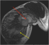 Fig. 4