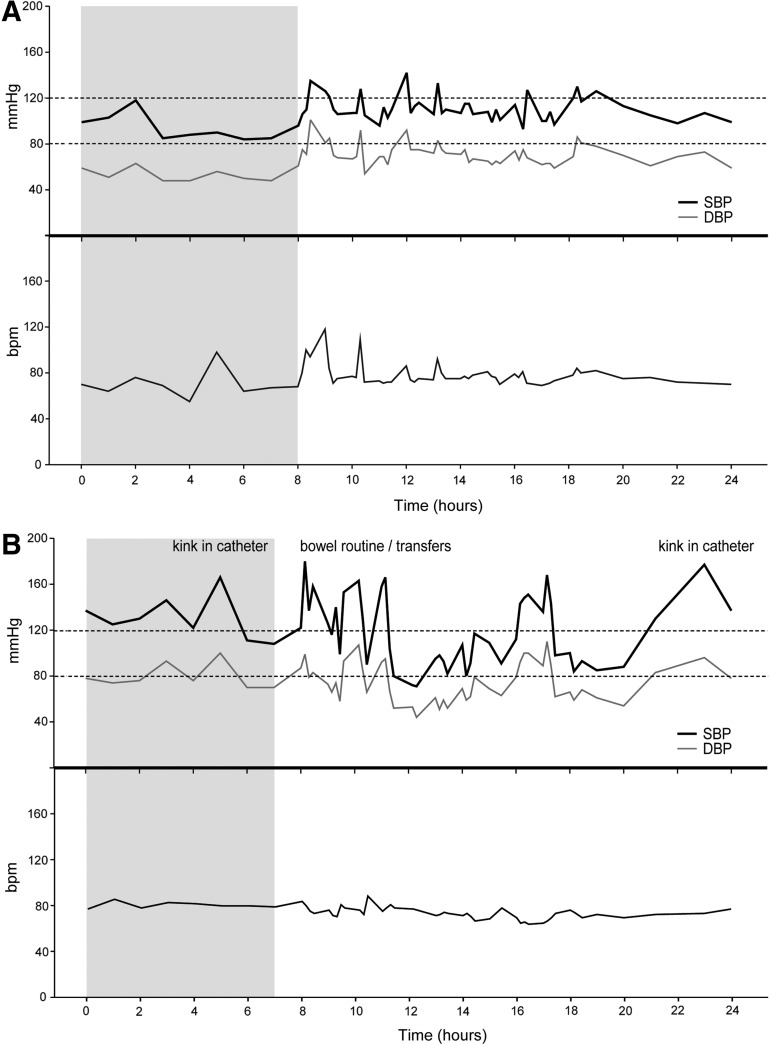 FIG. 4.