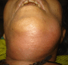 Fig. 4