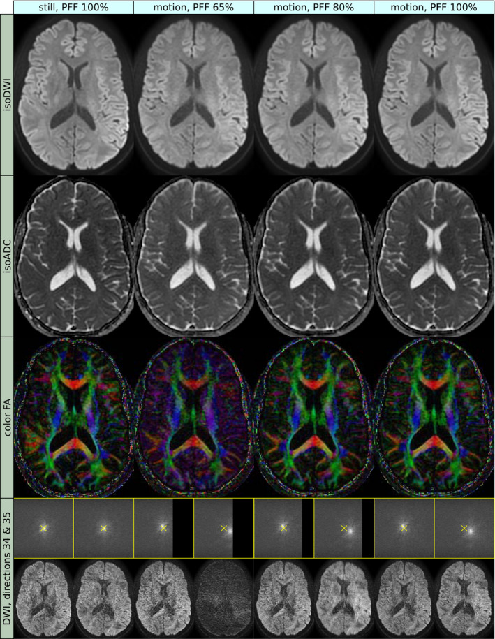 FIGURE 4