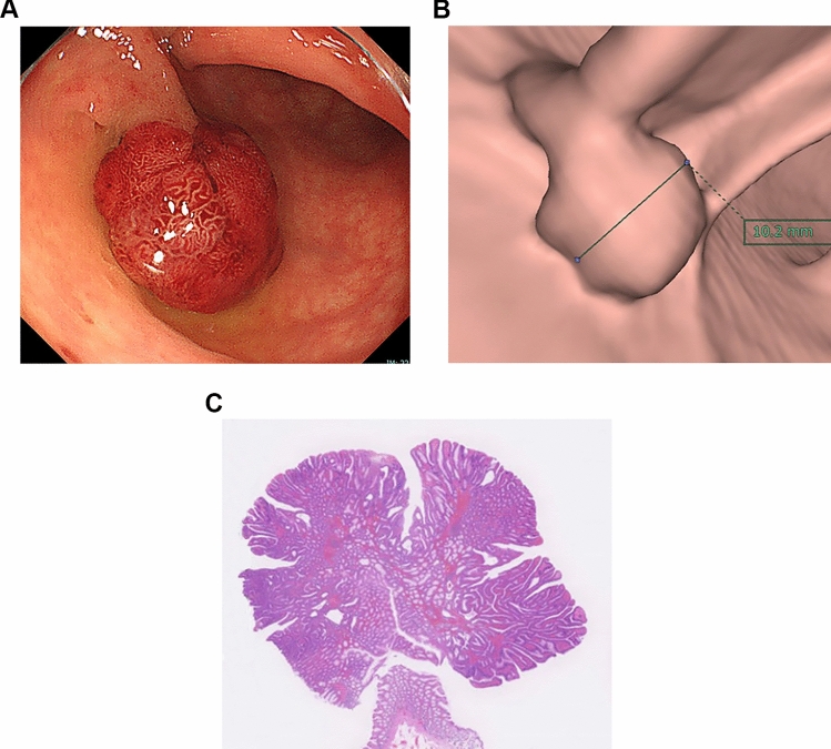 Fig. 2