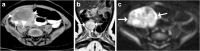 Fig. 12