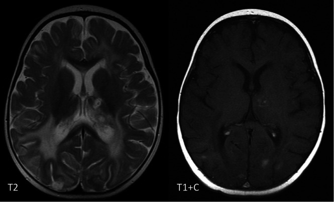 FIG 13.