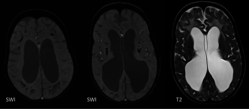 FIG 14.