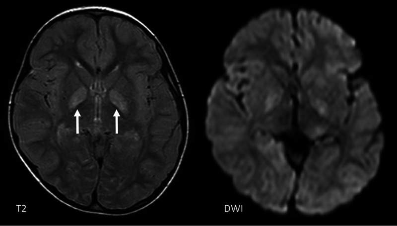 FIG 11.