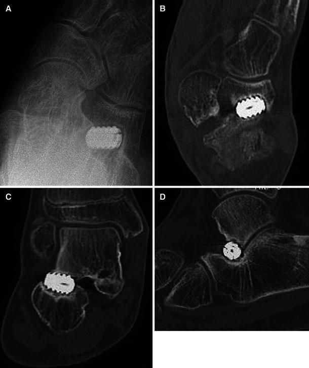 Fig. 9