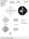 Fig. 11