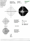 Fig. 13