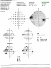 Fig. 12