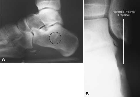 Fig. 1A–B