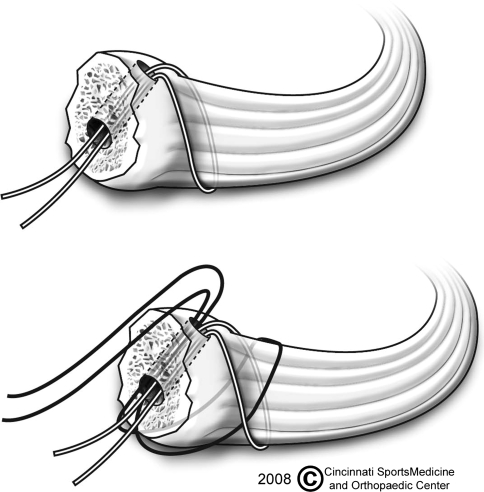 Fig. 3