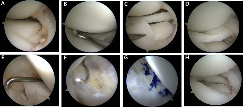 Fig. 5