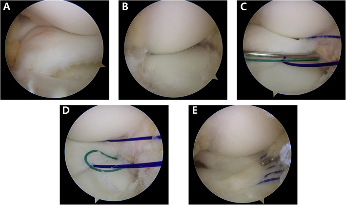 Fig. 4