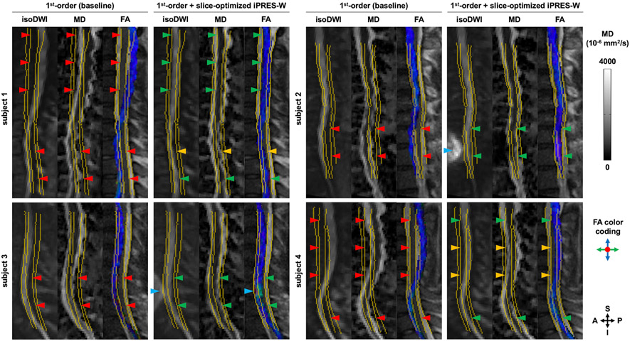 An iPRES-W Coil Array for Simultaneous Imaging and Wireless Localized ...