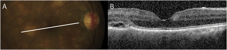 Fig. 3