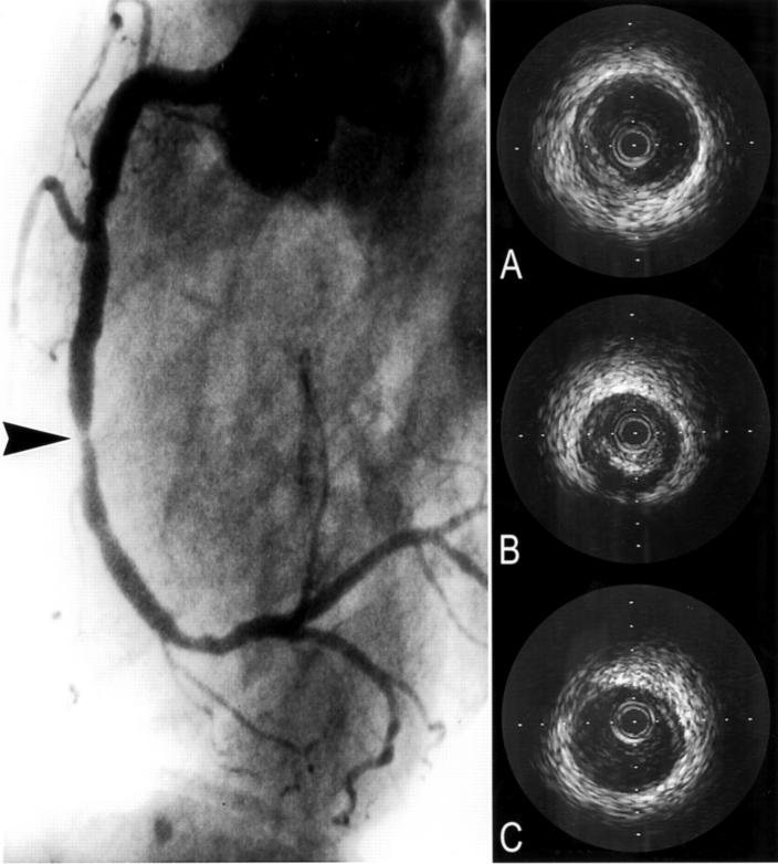 Figure 1  