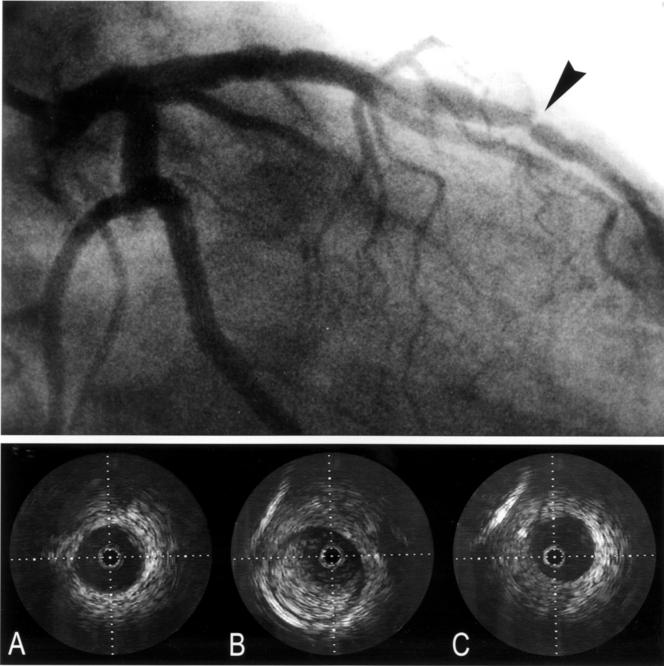 Figure 2  