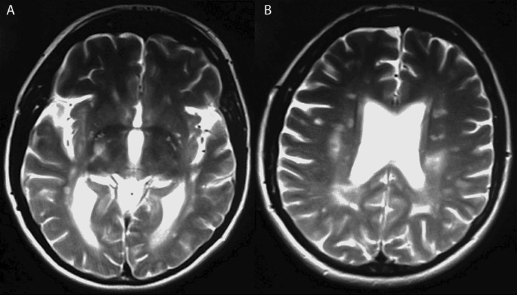 Figure 2