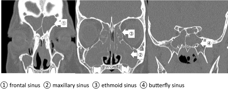 Fig. 1