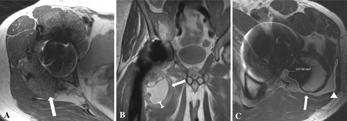 Fig. 2A–C