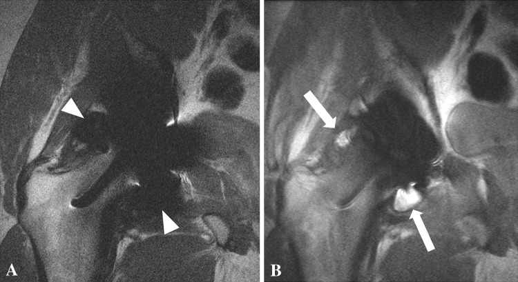 Fig. 1A–B