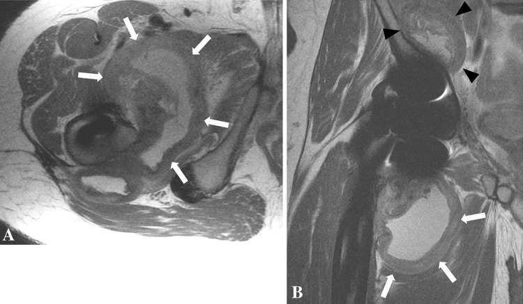 Fig. 8A–B