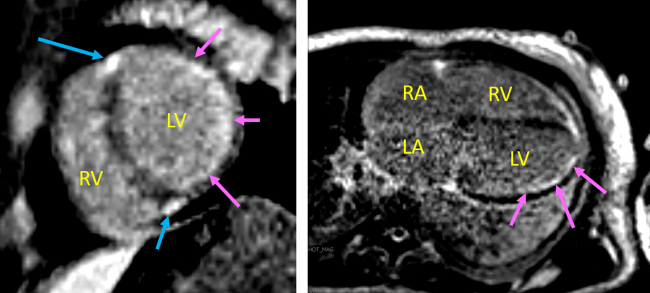 Figure 4