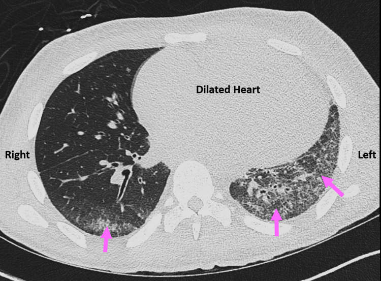 Figure 3