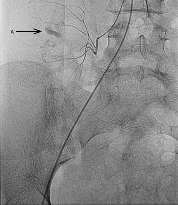 Figure 4