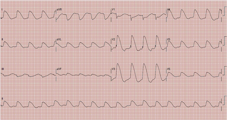 Figure 1