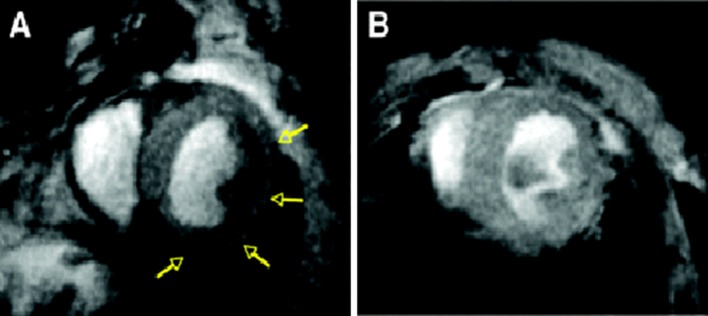 Fig. 5