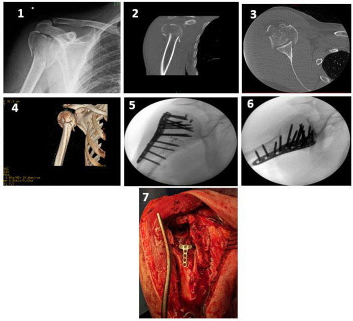 Figure 1-7