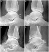 Figure 14