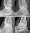 Figure 15