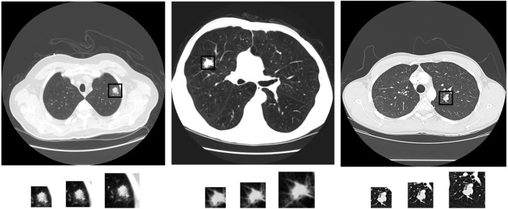 Fig 1