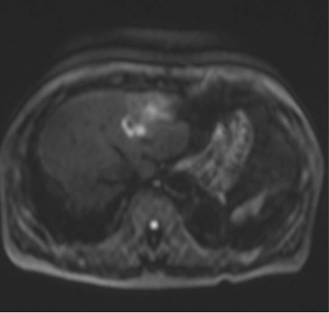 Fig. 6