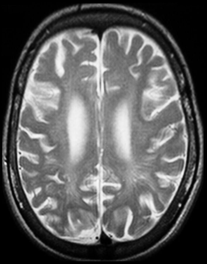 Fig 4.