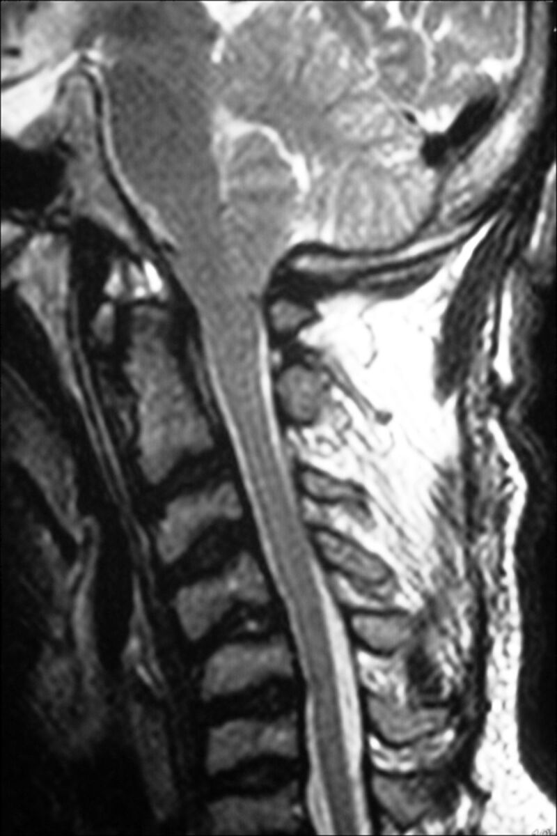 Fig 6.