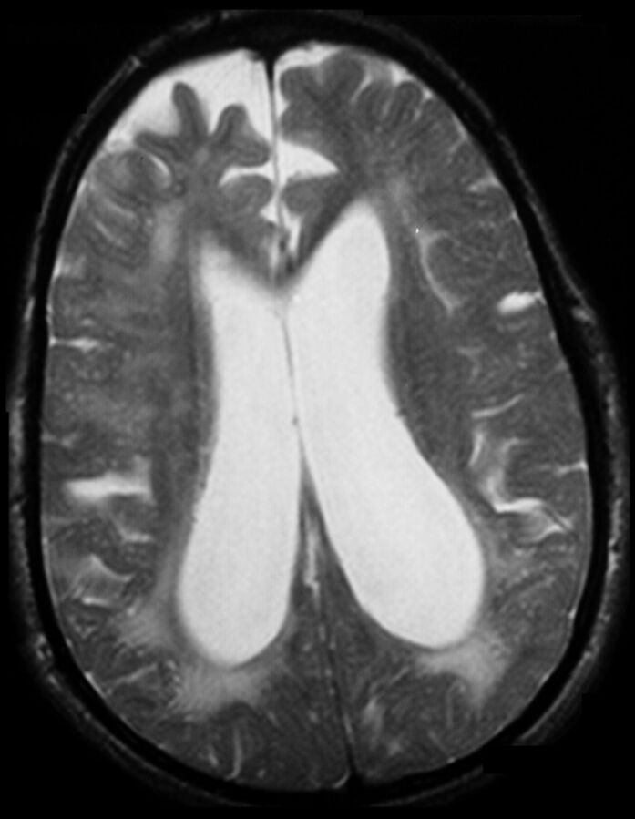Fig 3.